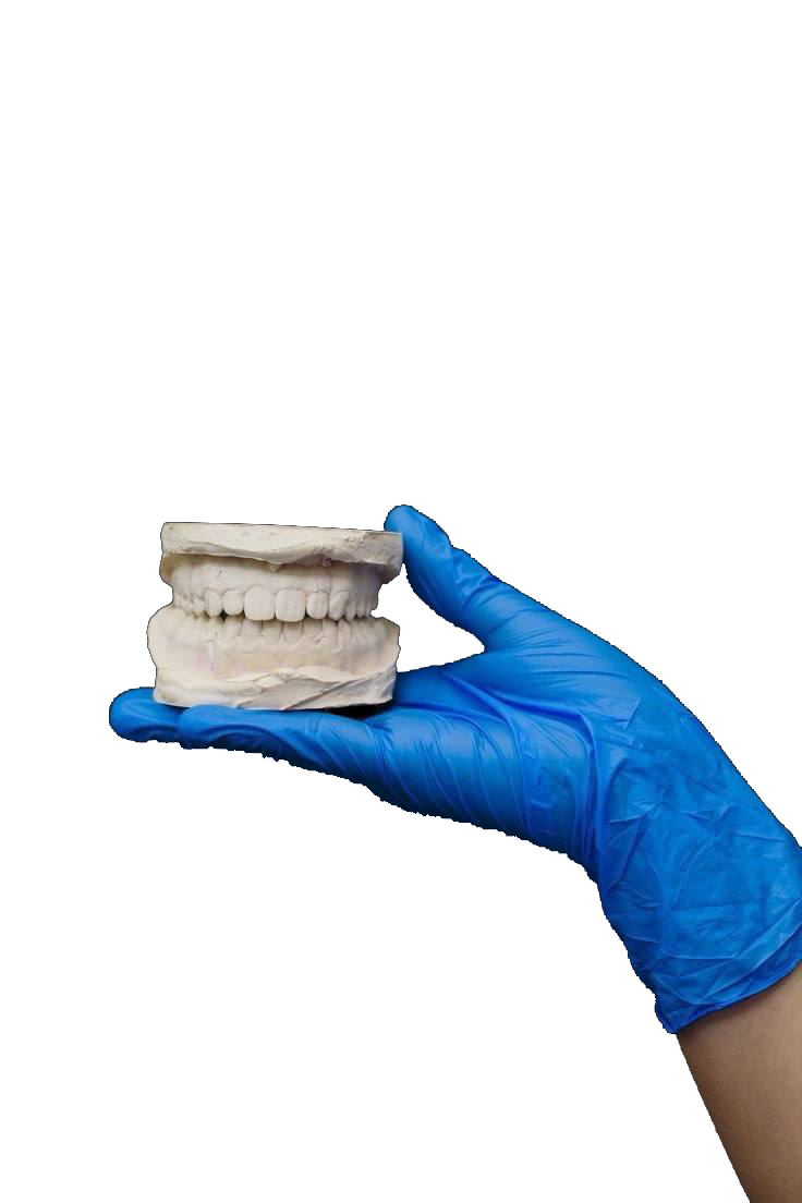 Протезирование зубов на имплантах