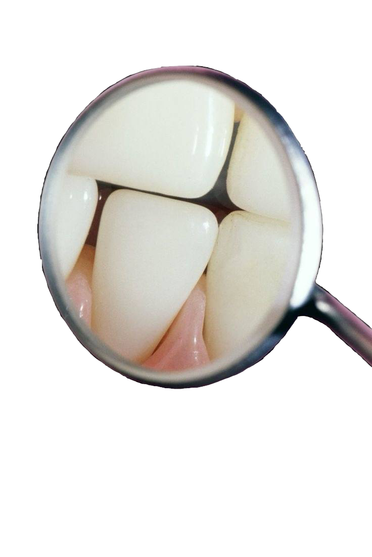 Зубные украшения